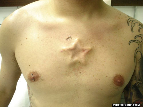 This tattoo is. Subdermal Implant